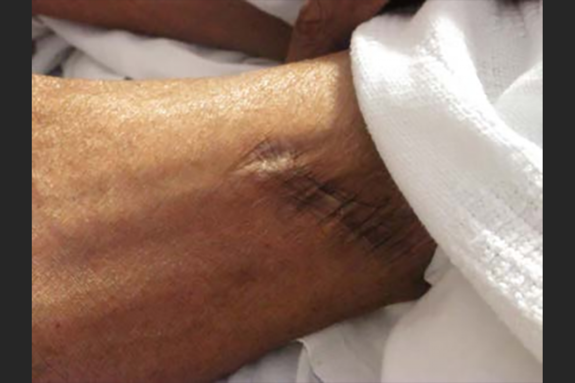 arm